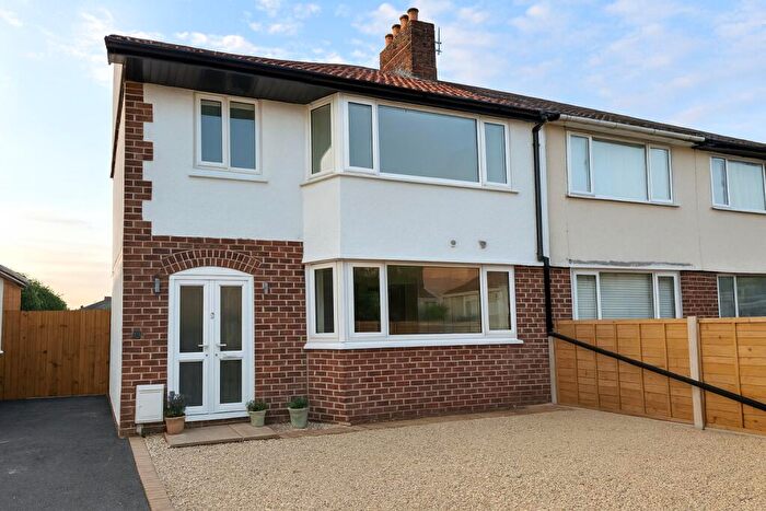 6 Bedroom Semi-Detached House To Rent In Alberton Road, Bristol, BS16